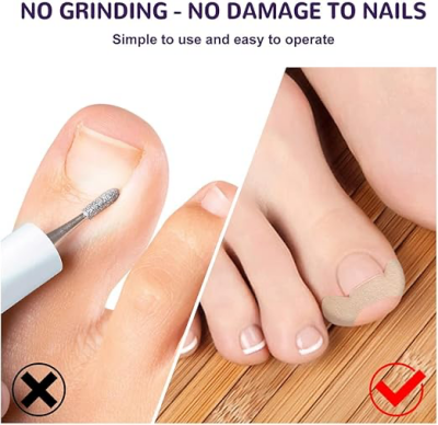 Ayak Tırnağı Düzeltme Bandı 50 Adet - 3